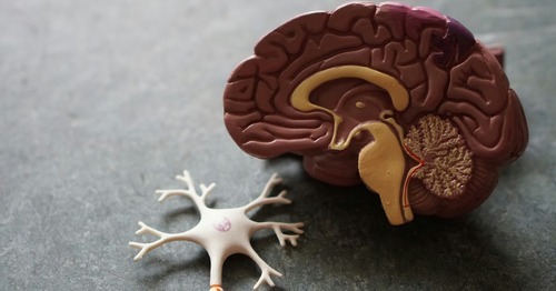 The broader societal impact of Alzheimer's disease in the Netherlands